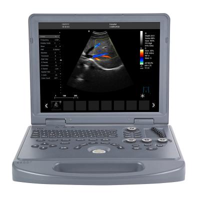 China Carejoy Handheld Scanner Echo Scanner Ultrasound Metal Laptop 15 Inch LED Screen Color Doppler Ultrasound Machine for sale