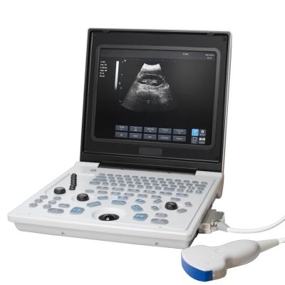 China carejoy Portable Metal 12 Inch LED Screen Display Digital Ultrasound Scanner Diagnostic System Full Convex Probe 3.5MHz for sale