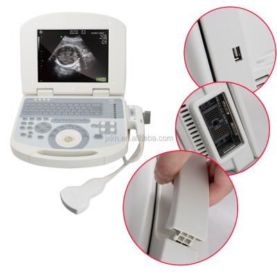 China CE Acrylic ISO Approved Medical Used Portable Obstetrics Gynecology Urology Cardiology Ultrasound Scanner Machine for sale