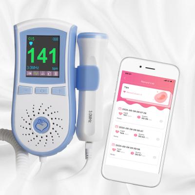 China 6.0Â ± 0.5cm2. Free Shipping USA 3.0MHz Color LCD Show 3.0MHz Doppler Ultrasound Fetal Baby Heartbeat Detector Free Data Item App for sale