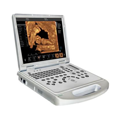 China Hot Sale MY-A024B-N Hospital Customized High Quality Portable Ultrasound Machine for sale