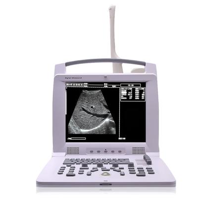 China ND Medical Device MY-A005 Portable Digital Ultrasound Machine Scanner With 3.5MHZ Convex Probe for sale