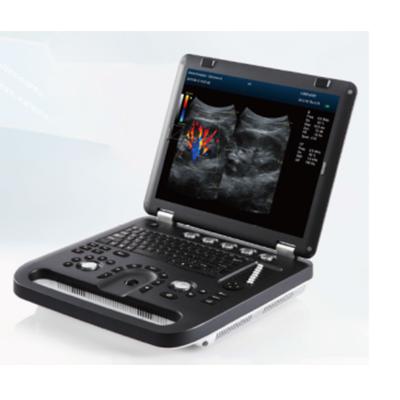 China OB Medical Device Ultrasonid MY-A024E Portable 15 inch LCD Screen Doppler China Ultrasound Machine for sale