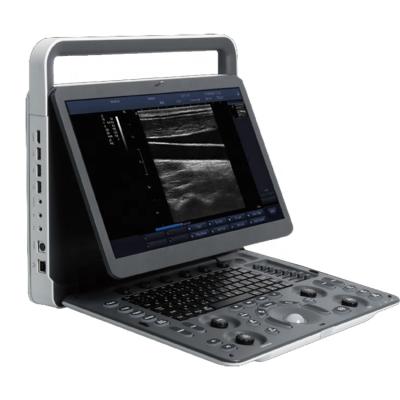 China Hospital Sonoscape E1 BW Ultrasound Scanning Machine 15.6 Inch LED Color Control Handheld Portable Dolphin for sale