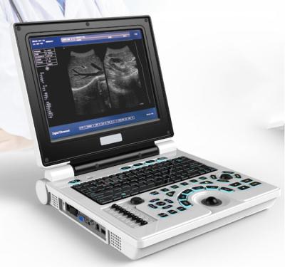 China High Quality Metal Medical Instrument Laptop Ultrasound Machine Ultrasound Scanning MY-A008D for sale