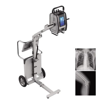 China X-ray room. X-ray service | MY-D019F Mobile Medical Device 14*17 Inch Flat Panel Detector Digital Portable X-Ray Machines for sale