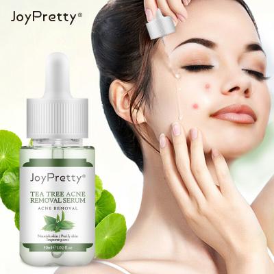 China Natural Skin Revitalizer Private Label Face Serum For Acne Removal Serum Scar Tea Tree Extract Brightening Facial Serum for sale