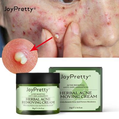 China Skin Revitalizer Korean Skin Care Product Acne Face Cream Pimple Treatment Anti Remove Blackhead Deep Repair Natural Facial Kit for sale