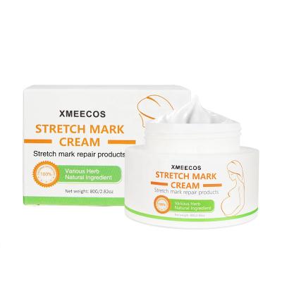 China Anti Nourishing Body Maternity Slack Pregnancy Skin Care Stretchmark Scar Repair Stretch Marks Removal Cream for sale