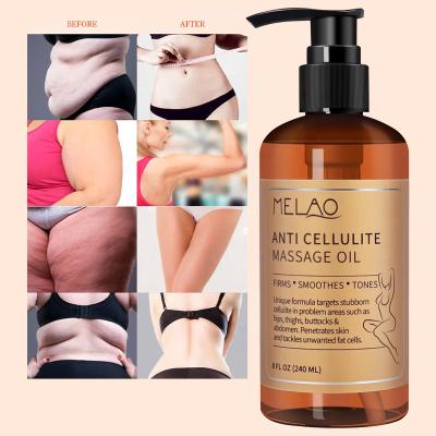 China Wholesale Melao body moisturizer slimming essential oil anti cellulite massage oil body massage oils infused with collagen for sale