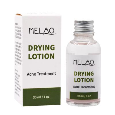 China MELAO Rich Tea Tree Super Acne Treatment Acne Treatment Drying Lotion 30ml for sale