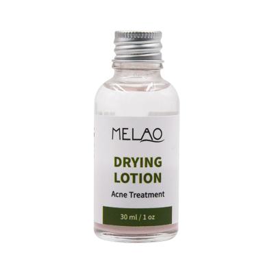 China Acne Treatment New Product MELAO All Natural Pure Acne Care Drying Facial Lotion for sale