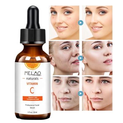 China Private Label Anti Aging Natural Organic Beauty Facial Skin Care 30ml Whitening Moisturizing 20% ​​Vitamin C Serum For Face for sale