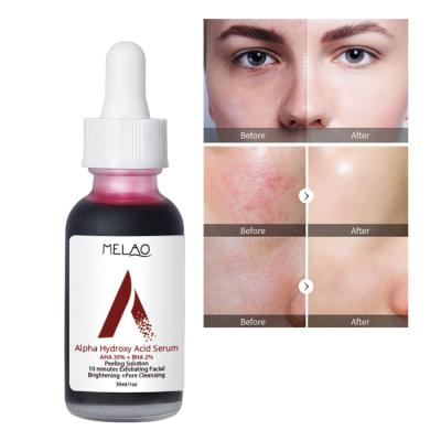 China Private Label 30% AHA 2% Alpha Hydroxy Acid Serum Organic BHA Peeling Solution Skin Care Face Serum Moisturizer 30ml for sale