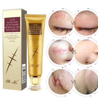 China Best Skin Moisturizer Acne Remover Pimple Treatment Face Cream Anti Spot Repair Organic Herbal Scar Cream for sale