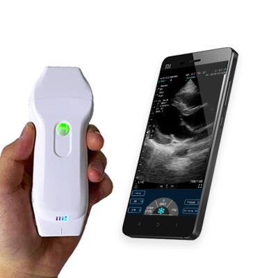 China High Quality New Technology Metal USB&WiFi Plug 3 in 1 Dual Head Color Doppler Ultrasound for sale