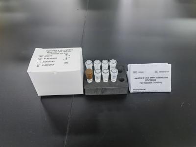 Κίνα Ηπατίτιδα Β ιός HBV ποσοτική PCR KIT Ευαισθησία δείγματος Τύπος δοκιμής Kit με 96 δοκιμές προς πώληση