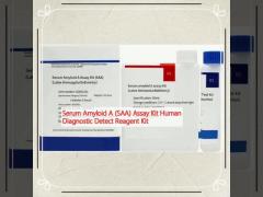 Serum Amyloid A (SAA) Assay Kit Human Diagnostic Detect Reagent Kit