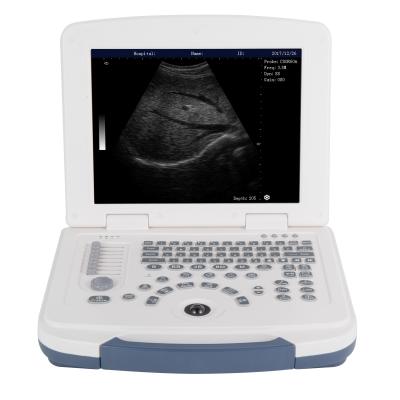 China OB Elements Portable Black And White Ultrasound Machine Black And White Doppler Ultrasound LX-BW-L6 128 for sale