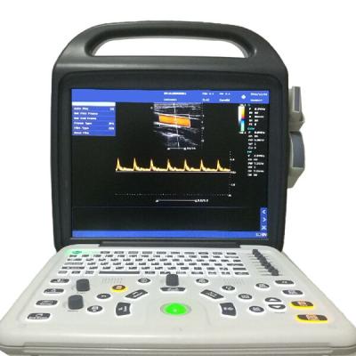 China OB LX-CB-P1 LUVXOM Best Build-in Ultrasound Color Doppler Portable Ultrasound Machine for sale