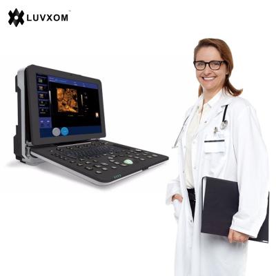 China OB LUVXOM LX-CB-P2 4D Color Doppler Portable Ultrasound Diagnostic Ultrasound Machine for sale