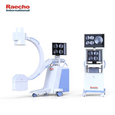 China Metal High Frequency Mobile C-arm Medical System CE / ISO Approved Digital C-arm Medical X-ray Machine for sale