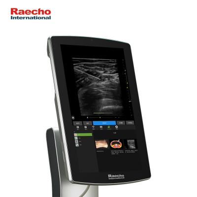 China For Anesthesia Hospital Ultrasound Cart Color Doppler Ultrasound Diagnostic Machine for sale