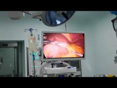 Bariatic Surgery