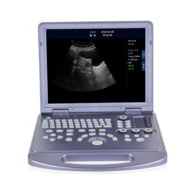 China RC-BW360 Metal PC Platform Laptop Black And White Ultrasound Machine For Vet Surgery Use for sale