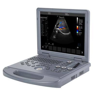 China Economic Portable 15 Inch Metal Color Doppler Laptop Ultrasound Machine RC-L3 for sale