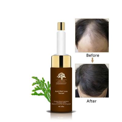 China World's Best Hair Regrowth Product Blue Copper Peptide Tonic Bio Loss Prevention Anti Alopecia for sale