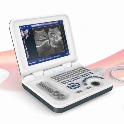 China Portable Echocardiography Obstetrics Gastroenterology B14-N Laptop Ultrasound Machine Scanner Price B14 for sale