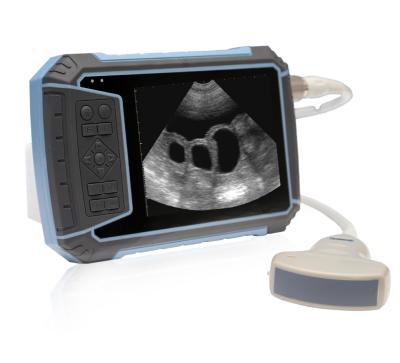 China V20-N Good Quality Portable Full Digital Veterinary Ultrasound Scanner For Sale Inch TFT LCD/Veterinary Ultrasound 5.7 5.7 Inch TFT LCD for sale