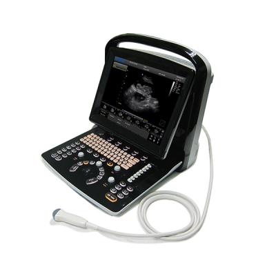 China Ultrasound Abdominal Medical Instruments Portable Black And White Ultrasound Scanner Price for sale