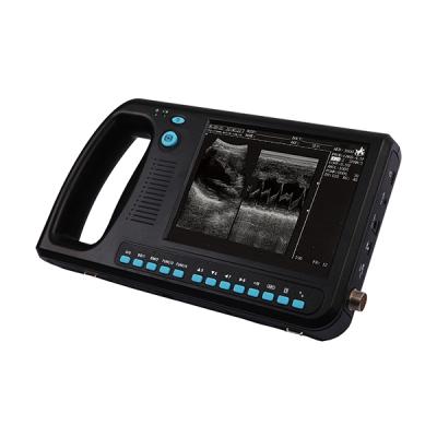 China Cheapest Price Laptop Digital Metal 15 Inch Gynecology Obstetrics Medical Ultrasound Scanner for sale