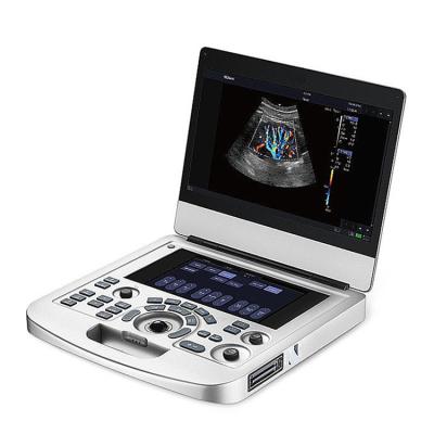 China EDAN Acclarix AX2 Color Hospital Doppler Medical Portable Ultrasound Equipment Medical Ultrasound Instruments for sale