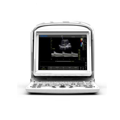 China Room Chison ECO1 Ultrasound Machine Surgical Portable Black And White Ultrasound Scanner for sale