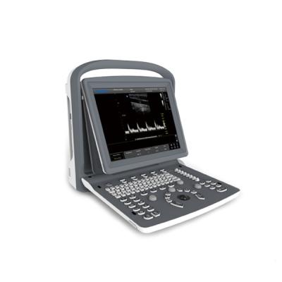 China Surgical Room Chison ECO2 CE Approved BW Ultrasound Scanner High Quality Portable Ultrasound Scanner for sale