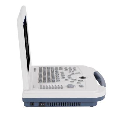 China Plastic New Design Laptop Medical Ultrasound Scanner For Wholesales Medical Ultrasound for sale