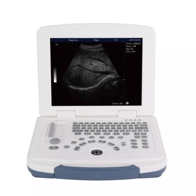 China Hot Selling Plastic Medical Ultrasound Machine Ultrasound Scanner for sale