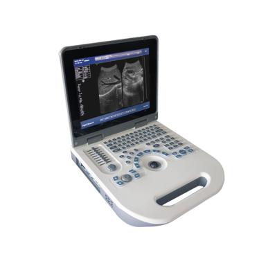 China Full Plastic Portable Digital LED Ultrasound Black And White Ultrasound for sale