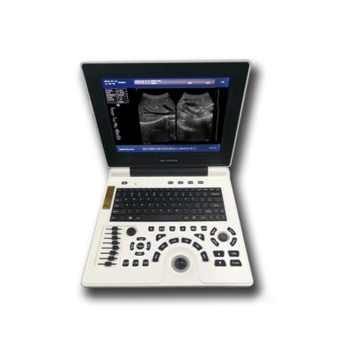 China B/W Doppler Plastic Ultrasound Notebook Full Digital Ultrasound for sale