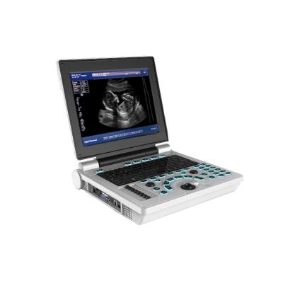 China Full Plastic Digital Laptop Ultrasound Notebook B/W Ultrasound Doppler Ultrasound for sale