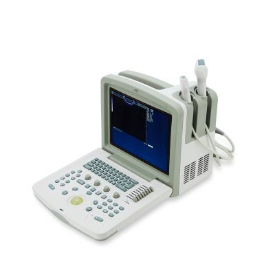 China Portable Abdomen CE 12.1 Inch Convex Ultrasound Scanner Medical Ultrasound System for sale