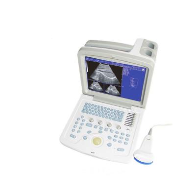 China Medical Ultrasound Convex Ultrasound Scanner Machine Abdomen Ultrasound System for sale