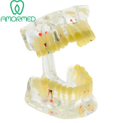 China Plastic Dental Teeth Model For Dental Medical Teaching for sale